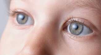 Причины возникновения врожденной катаракты у детей