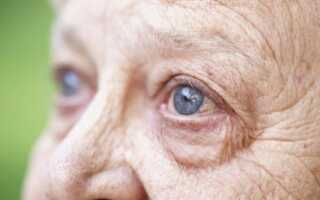 Возрастные изменения зрения: старческая катаракта