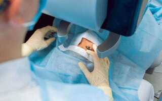 Говорит офтальмолог: правильная подготовка к лазерной коррекции зрения — залог хорошего результата