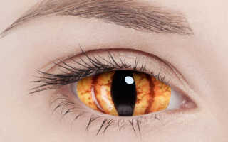 Инновационный метод коррекции зрения — склеральные линзы: что это такое и как применять