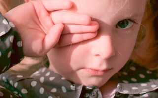 ТОП-5 причин, почему не проходит конъюнктивит у ребенка
