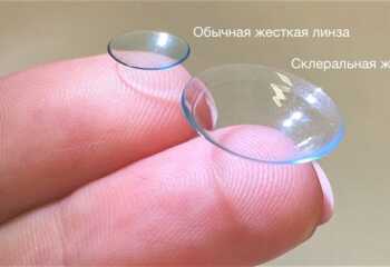 Как подобрать жесткие контактные линзы для коррекции зрения