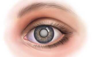 Вам поставлен диагноз катаракта? Операция — самый эффективный способ лечения