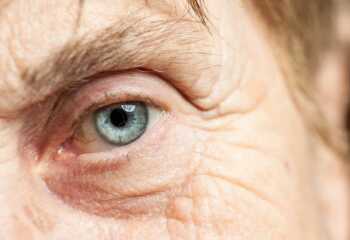 Как сохранить ясный взгляд: существует ли профилактика катаракты?