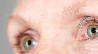 Как не допустить катастрофы: первые признаки катаракты и глаукомы на ранних стадиях