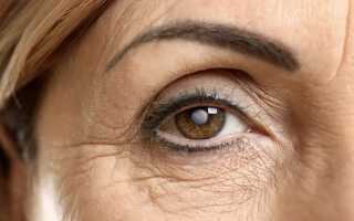 Вам поставили диагноз катаракта глаза? Что это такое и как жить дальше