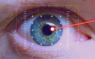 Вся правда:больно ли делать лазерную коррекцию зрения?