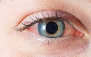 Какие глазные капли от покраснения и раздражения самые эффективные?