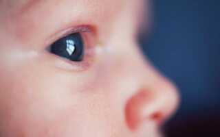 Самые распространенные заболевания глаз у детей: причины, симптомы, лечение
