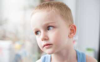 5 основных причин, по которым появляются мешки под глазами у ребенка