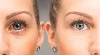 Заразны ли заболевания глаз? как передается конъюнктивит?