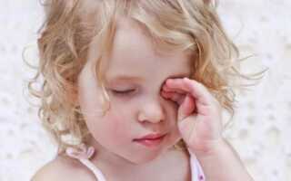Мамин справочник: как лечить аллергический конъюнктивит у ребенка?