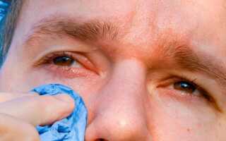 Как и чем промывать глаза при конъюнктивите