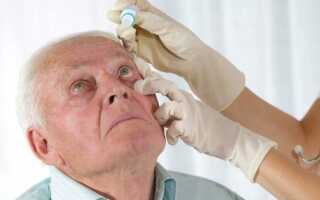 Диагноз катаракта: лечение народными средствами — 10 самых эффективных рецептов