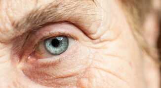 Как формируется зрелая катаракта?