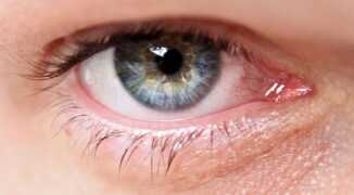 Что можно пить при глаукоме? Противопоказаны препараты при повышенном ВГД