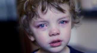 5 причин, по которым у ребенка красные глаза и гноятся