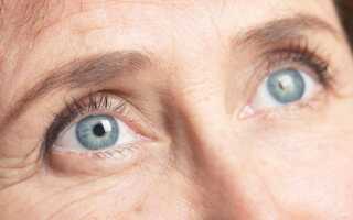 Спросим специалиста: что такое бельмо на глазу и как его лечить?