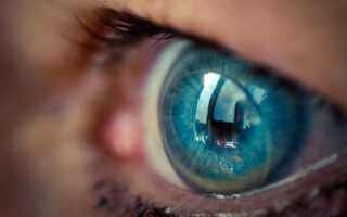 Почему болят глаза от линз? Как справится с недугом в домашних условиях