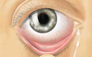 Как лечить вирусные заболевания глаз у человека?