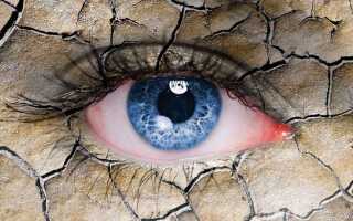 Ксерофтальм или синдром сухого глаза: почему возникает и как побороть заболевание?