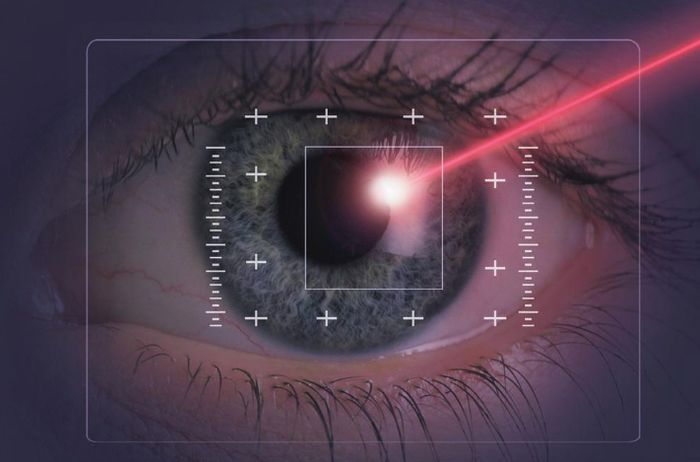 Лазерная коагуляция сетчатки глаз