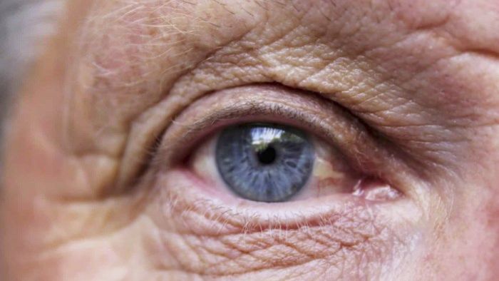 Глаз пожилой женщины
