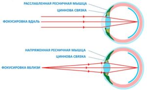 Расфокусировка зрения фото глаз