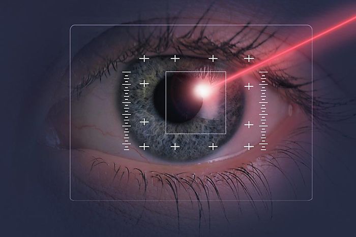 Лазерная операция на глаза