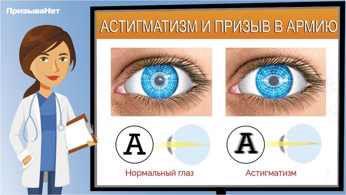 Заболевание глаз - астигматизм