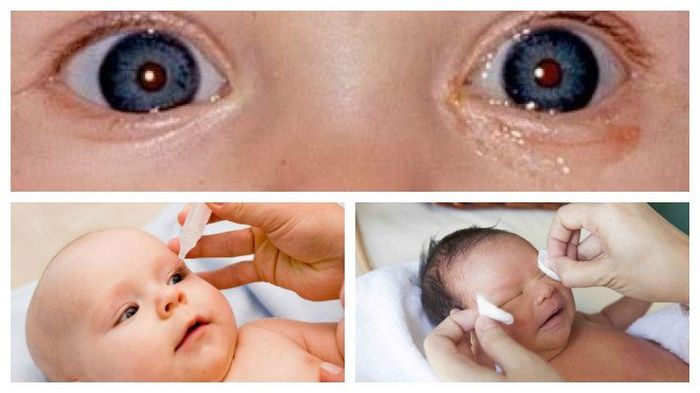 Лечение глаз у детей