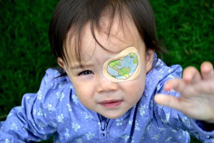ребенок с повязкой на глазу после операции
